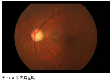 ZY016_158_5.gif